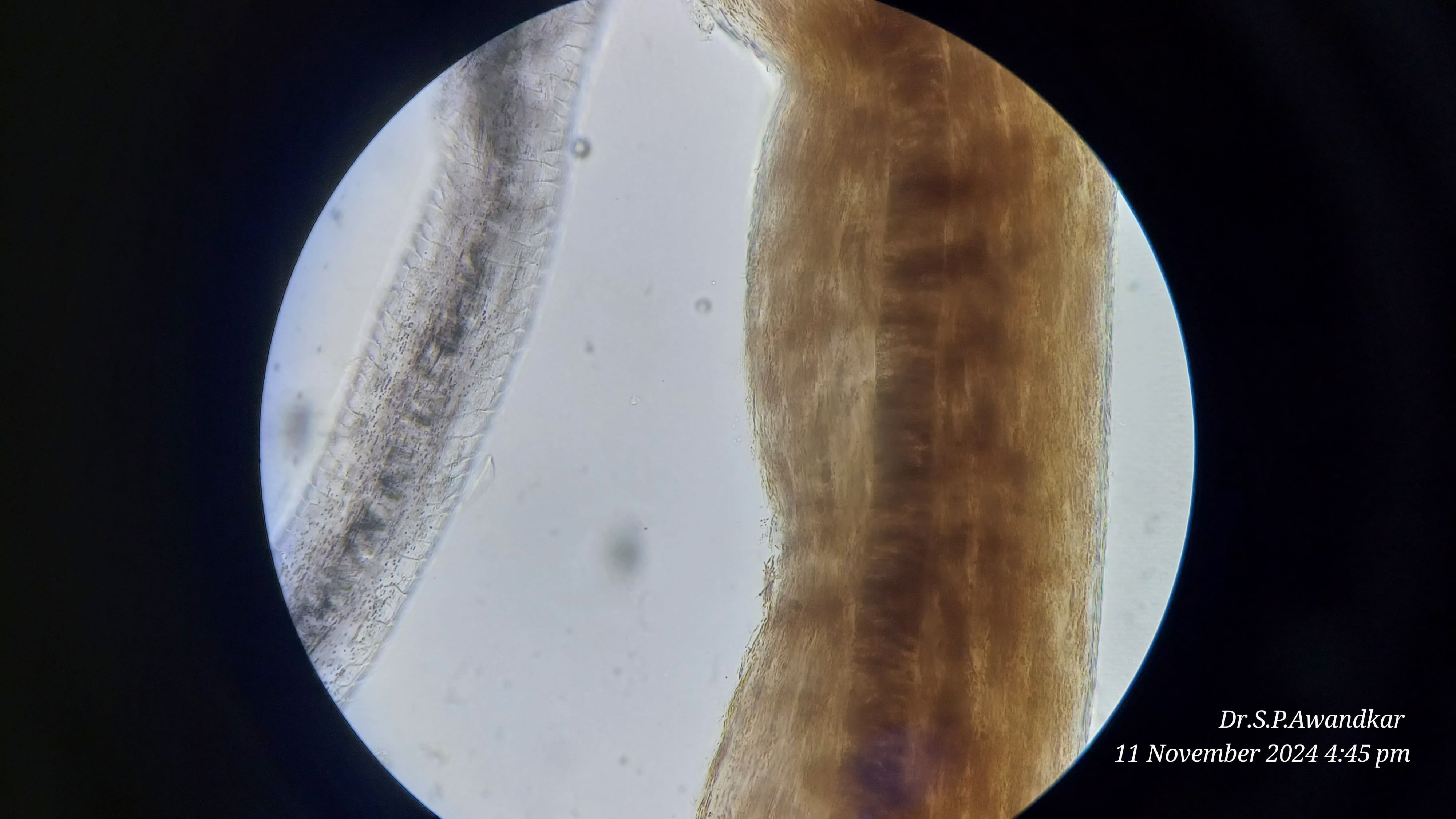 27. Endothix